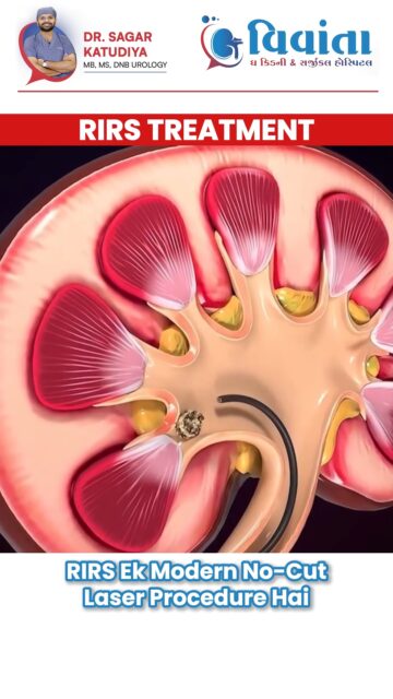 End the Pain of Kidney Stones Today! 🚫💎

Are you or a loved one suffering from kidney stone pain? Experience the future of treatment at Vivanta Kidney & Surgical Hospital.

We specialize in RIRS (Retrograde Intrarenal Surgery)—a modern, no-cut laser procedure that removes stones without incisions. Using high-precision laser technology, this approach is almost painless and ensures a very quick recovery, getting you back to your life faster.

Don’t wait for the pain to get worse. Trust Dr. Sagar Katudiya and our expert team for the best urological care in Surat.

👨‍⚕️ Dr. Sagar Katudiya
MB, MS, DNB Urology | Vivanta The Kidney & Surgical Hospital
📞 For consultations, call now:
📲 +91 94272 65827 | +91 99046 99029
📍 404-406, 4th Floor, Aditya Complex-B, VIP Circle, Utran, Surat, Gujarat

#VivantaHospital #KidneyStoneTreatment #RIRS #DrSagarKatudiya #UrologySurat #NoCutSurgery #LaserTreatment #KidneyHealth #SuratDoctors #MedicalAdvancement #Urologist #HealthCareIndia #KidneyStoneRemoval #PainlessSurgery #UrologyCare #SuratHealth #VivantaKidneyHospital #HealthyLiving #MedicalInnovation #KidneySpecialist #Nephrology #SuratCity #ModernMedicine #HealthTips #UrologyTips

( RIRS treatment, kidney stone removal, Vivanta Kidney Hospital, Dr. Sagar Katudiya, laser kidney surgery, no cut kidney surgery, urology hospital Surat, best urologist in Surat, retrograde intrarenal surgery, kidney stone laser treatment, minimally invasive surgery, urological procedures, kidney health tips, RIRS surgery animation, medical technology, kidney stone pain relief, urology clinic, surgical hospital Surat, Dr. Bipin Jayani, healthcare Surat )