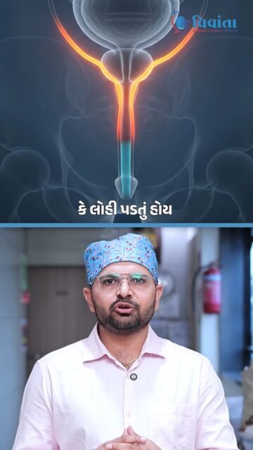 રાત્રે વારંવાર પેશાબ આવવો Nocturia તરીકે ઓળખાય છે. ક્યારેક તે વધારે પ્રવાહી પીવાથી થઈ શકે છે, પરંતુ જો આ સમસ્યા સતત રહેતી હોય તો તેનું કારણ શોધવું મહત્વપૂર્ણ છે.

પુરુષોમાં Enlarged Prostate (BPH) એક કારણ હોઈ શકે છે. આ ઉપરાંત Diabetes, Bladder Problems, UTI, કેટલીક દવાઓ અથવા ઊંઘ સંબંધિત સમસ્યાઓ પણ કારણ બની શકે છે.

જો સાથે પેશાબની ધાર નબળી થવી, પેશાબ શરૂ કરવામાં તકલીફ, urgency, બળતરા અથવા પેશાબમાં લોહી જેવા લક્ષણો હોય, તો Urologistની સલાહ લેવી યોગ્ય છે.

રાત્રે વારંવાર પેશાબને માત્ર ઉંમરની અસર માનીને Ignore ન કરો. યોગ્ય તપાસથી કારણ જાણી શકાય છે અને કારણ મુજબ સારવાર શક્ય છે.

📍 4th Floor, Aaditya complex - B, VIP Circle, Utran, Surat. 

📞: 0261-3642965 | 94272 65827

[ Nocturia, Frequent Urination, Night Urination, Enlarged Prostate, BPH, Prostate Treatment, Urinary Problems, Urology, Urologist, Kidney Health, Bladder Health, Surat ]