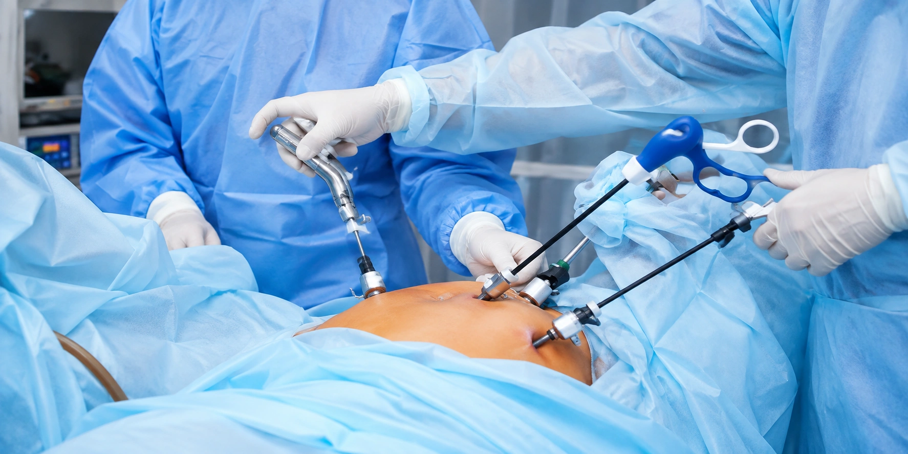 Laparoscopic Surgery in Surat