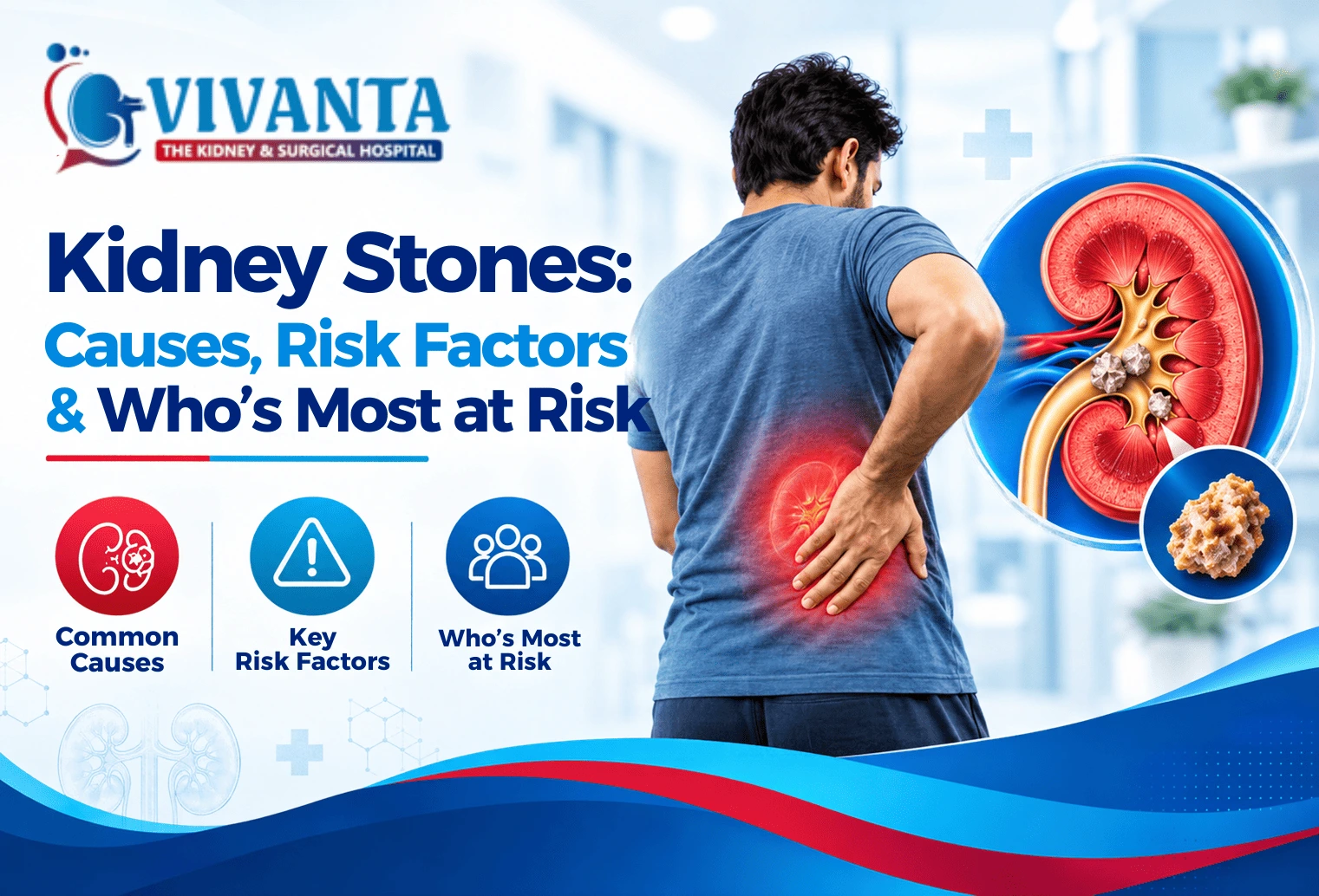 Kidney Stones Causes
